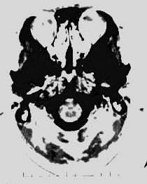 CAT scan of human head
